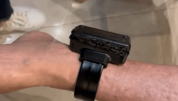 Bolsonaro diz que começou a queimar tornozeleira no final da tarde; veja