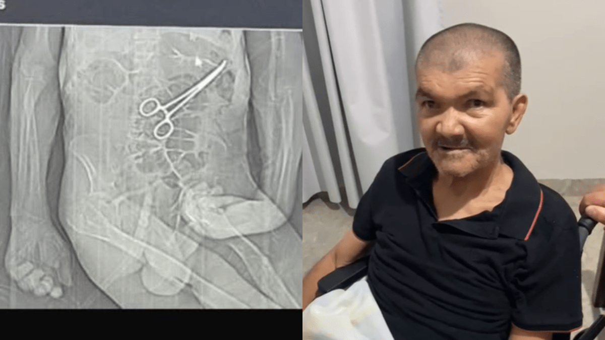 Idoso morre na véspera de Natal após pinça ser esquecida em seu corpo em MG